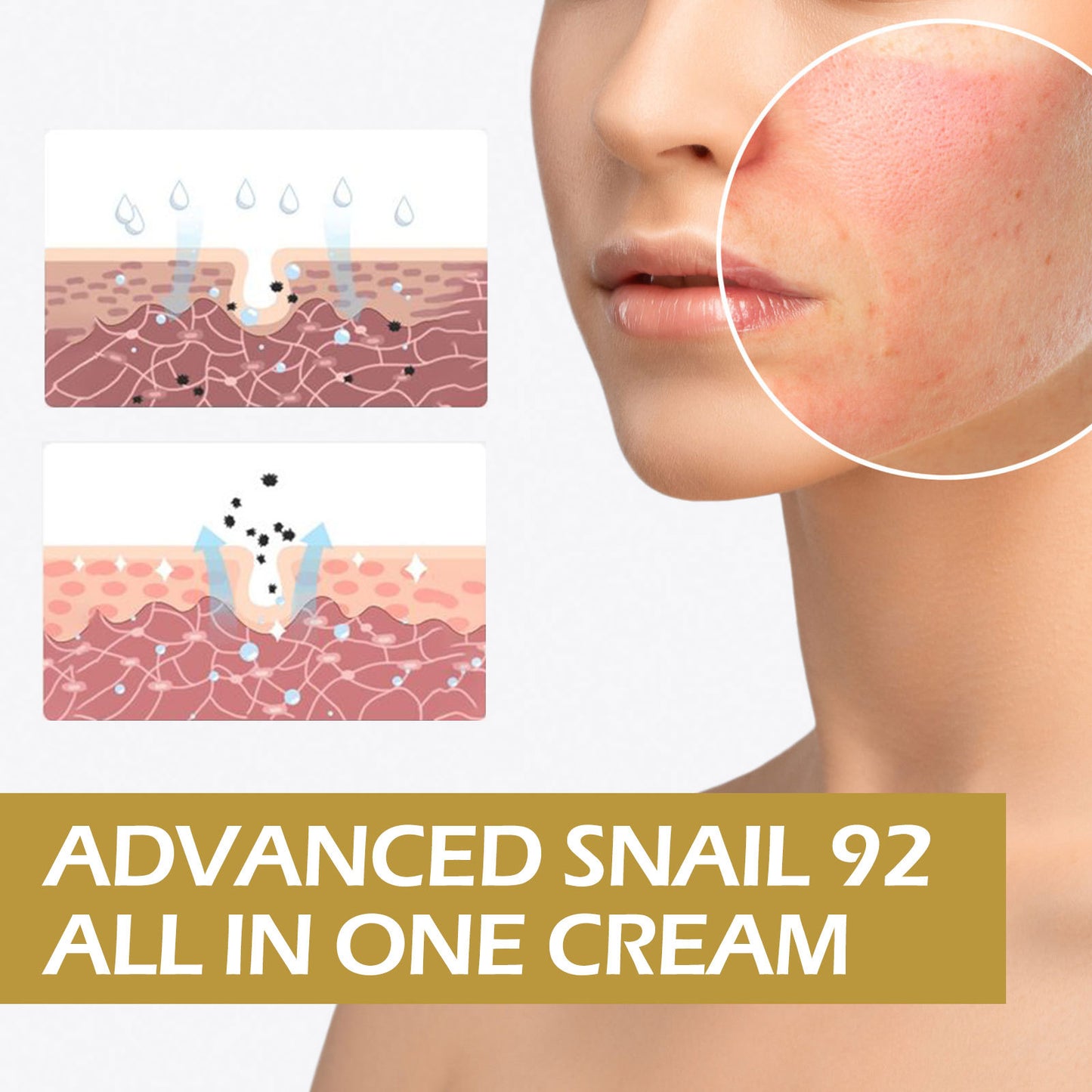 Snail Face Cream Anti Redness Pimple Removal Shrink Pores Repair Sensitive Skin Replenishing Moisturizer Acne Treatment Cream