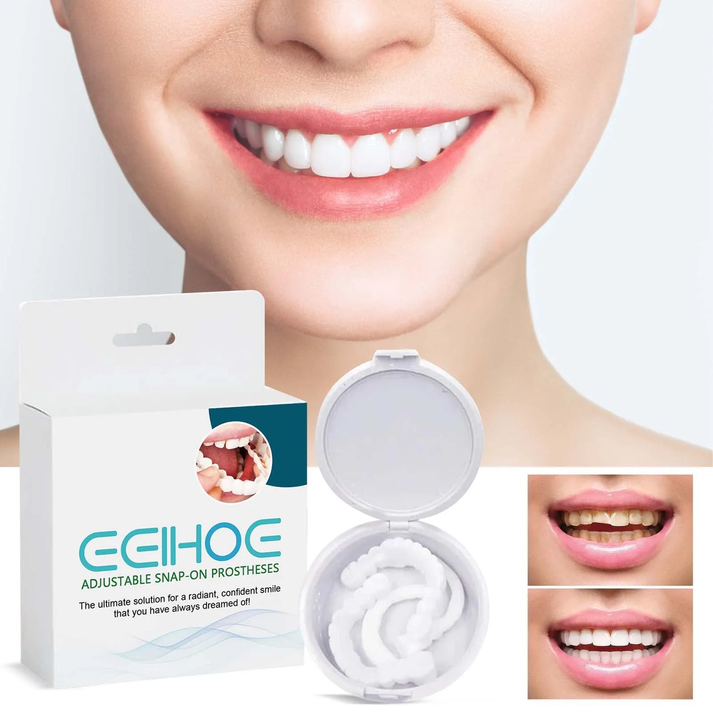 EELHOE Snap on Veneers Teeth Cosmetic Upper Lower Temporary Tooth Instant Confident Smile Perfect Fit Teeth Whitening Fake Tooth